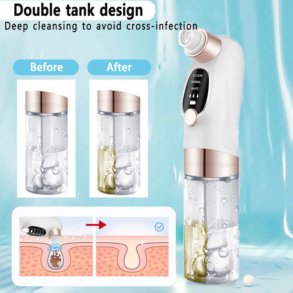 Pore Vacuum Cleaner