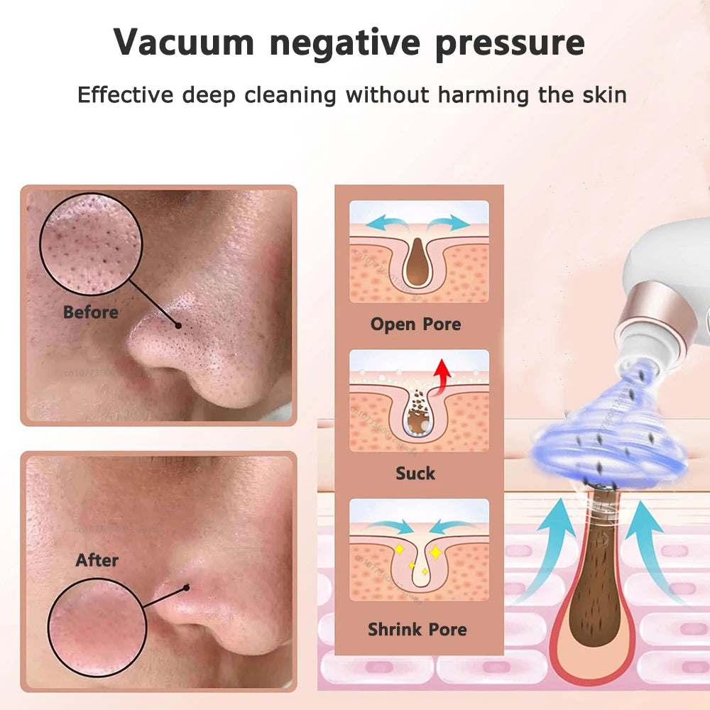 Pore Vacuum Cleaner